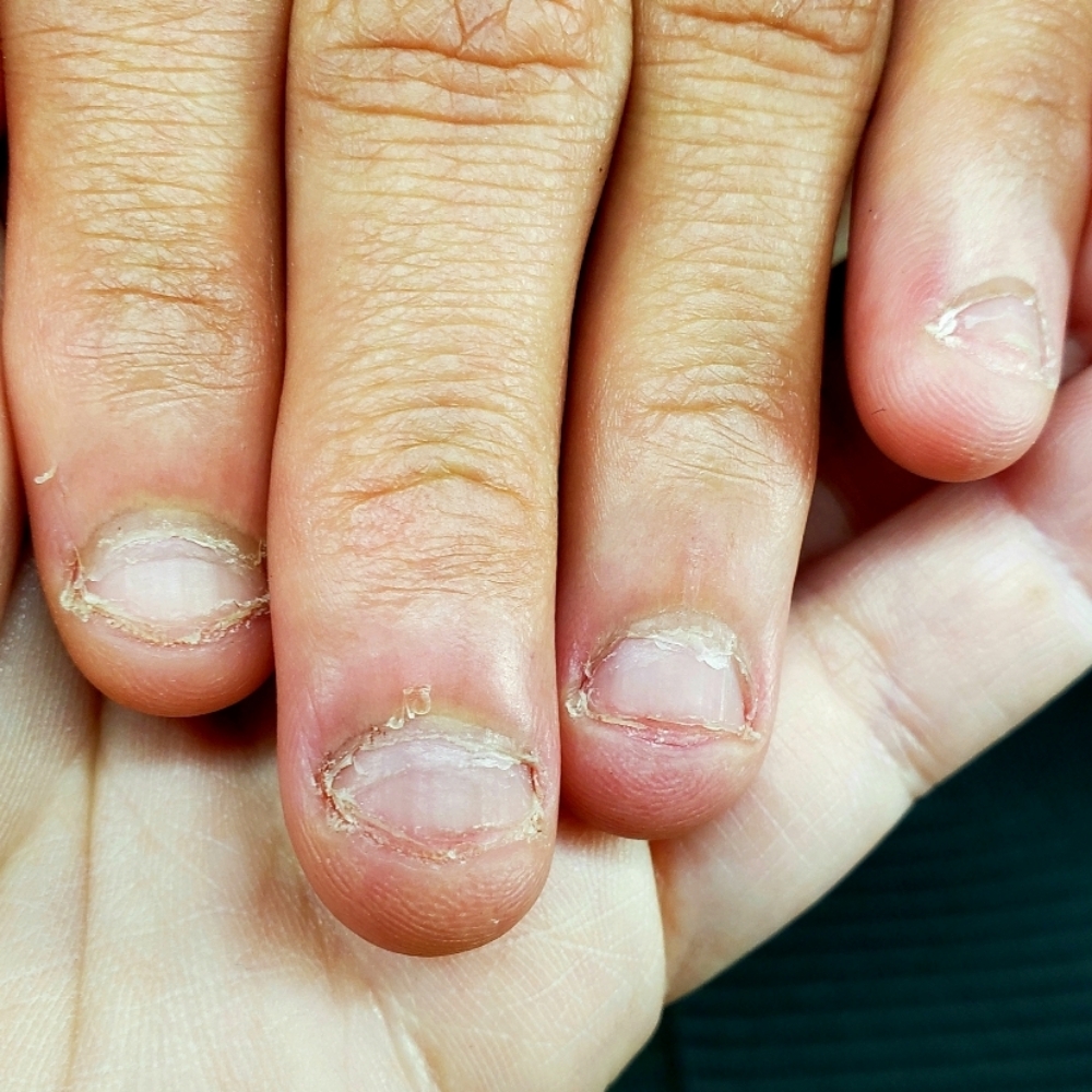 Nail Biter Mani at Rebellious Nails in Seattle, WA