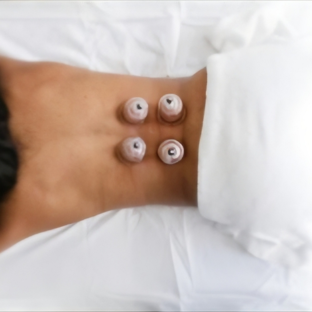 Myofascial Cupping at Infinite Massage By SAMMIEJO in San Antonio, TX