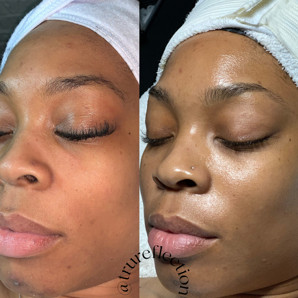 PCA Therapeutic Oatmilk Mask