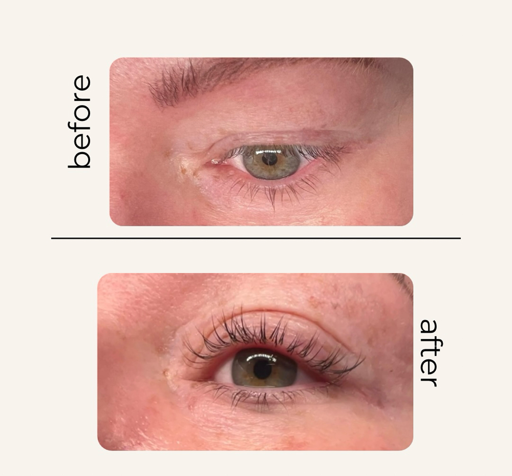 Lash Lift