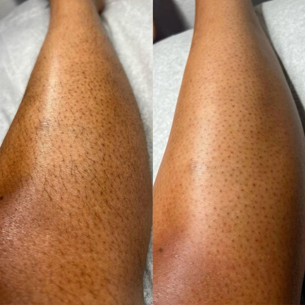 Half Leg at 9TwentyNine Waxing Co. in Arlington, TX