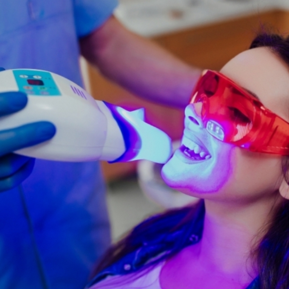 Teeth Whitening Session (60 Min) at Le Bar Beaute in Indian Trail, NC