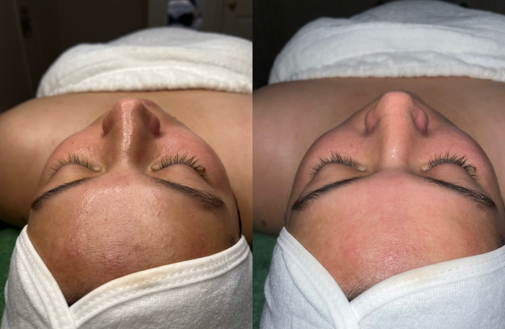 Classic Facial