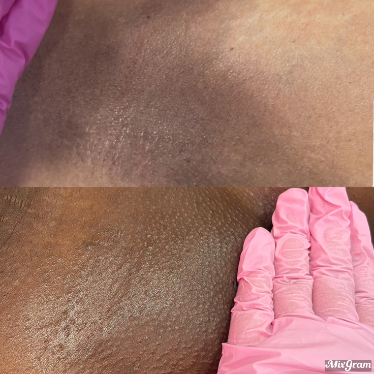 brazilian + underarm  wax combo
