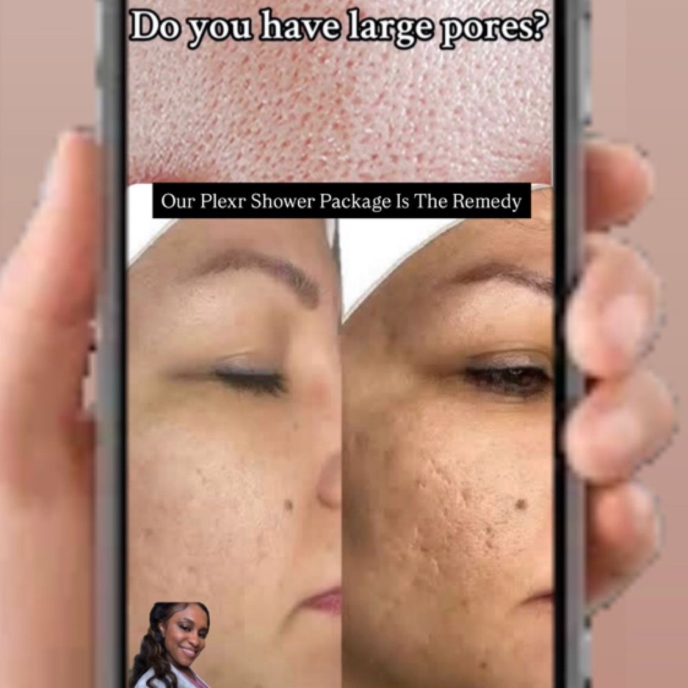 Plexr Needle Free Microneedling at Plump Haus LA in Beverly Hills, CA