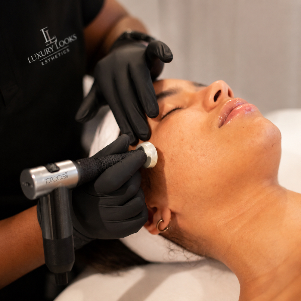 Luxe Procell Microchanneling at Luxury Looks Beauty & Esthetics in Manahawkin, NJ