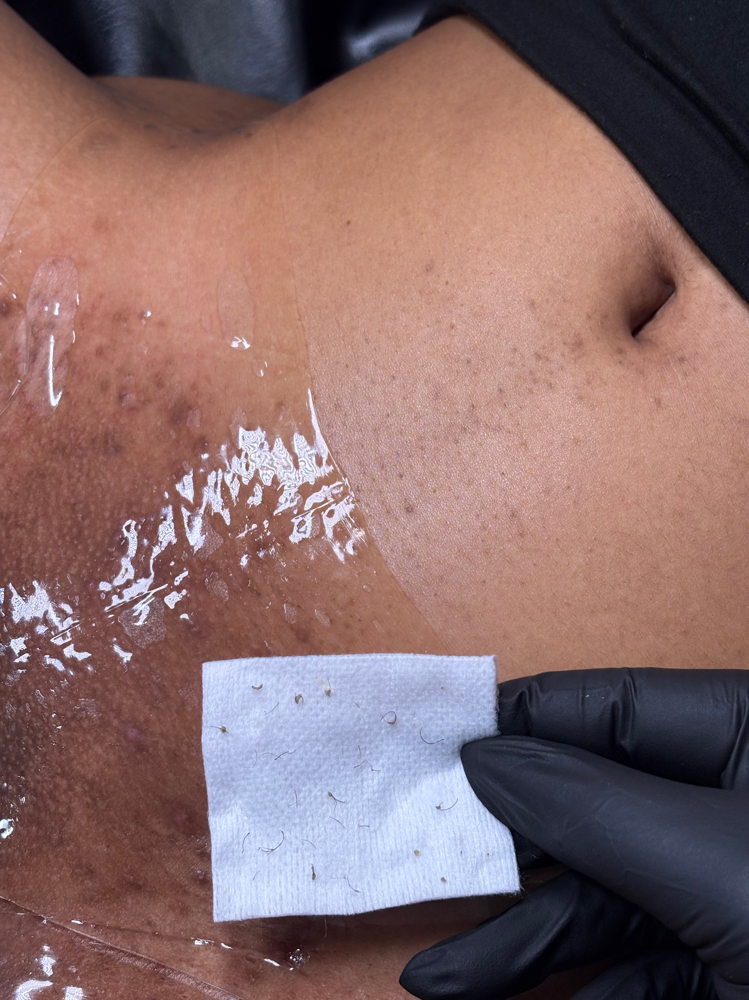 Brazilian Wax & Basic Vajacial