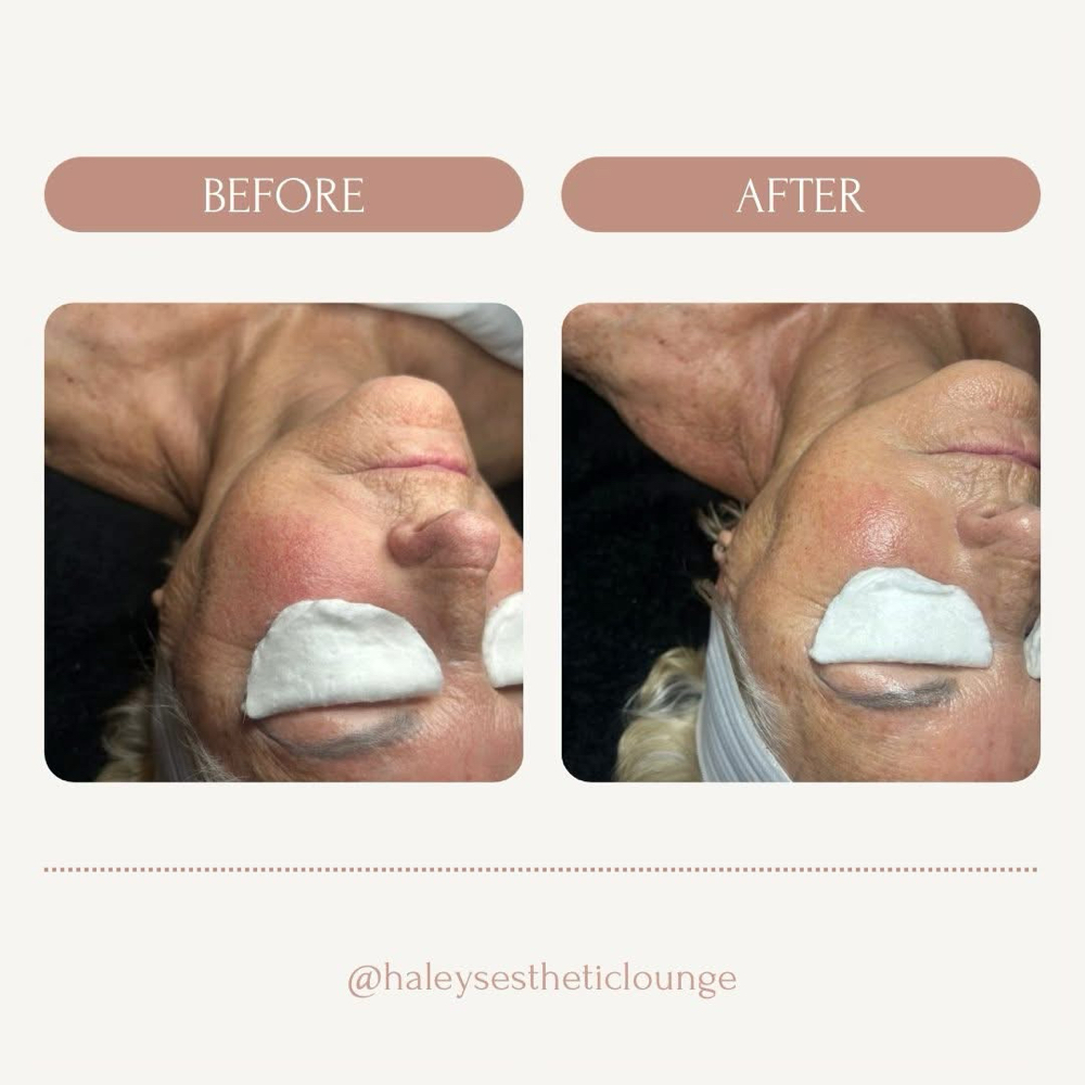 Soothing Hydration Facial