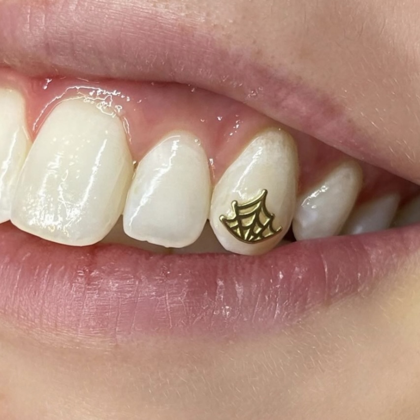 18K Gold Tooth Charm Application