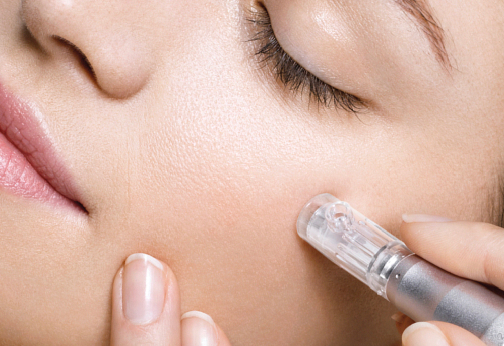 MICRONEEDLING