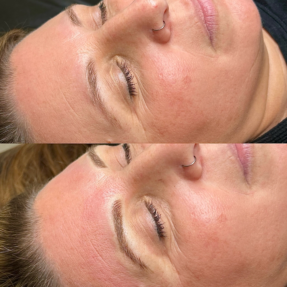 Microblading