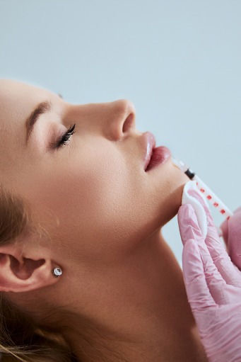 Lip Filler (half Syringe)