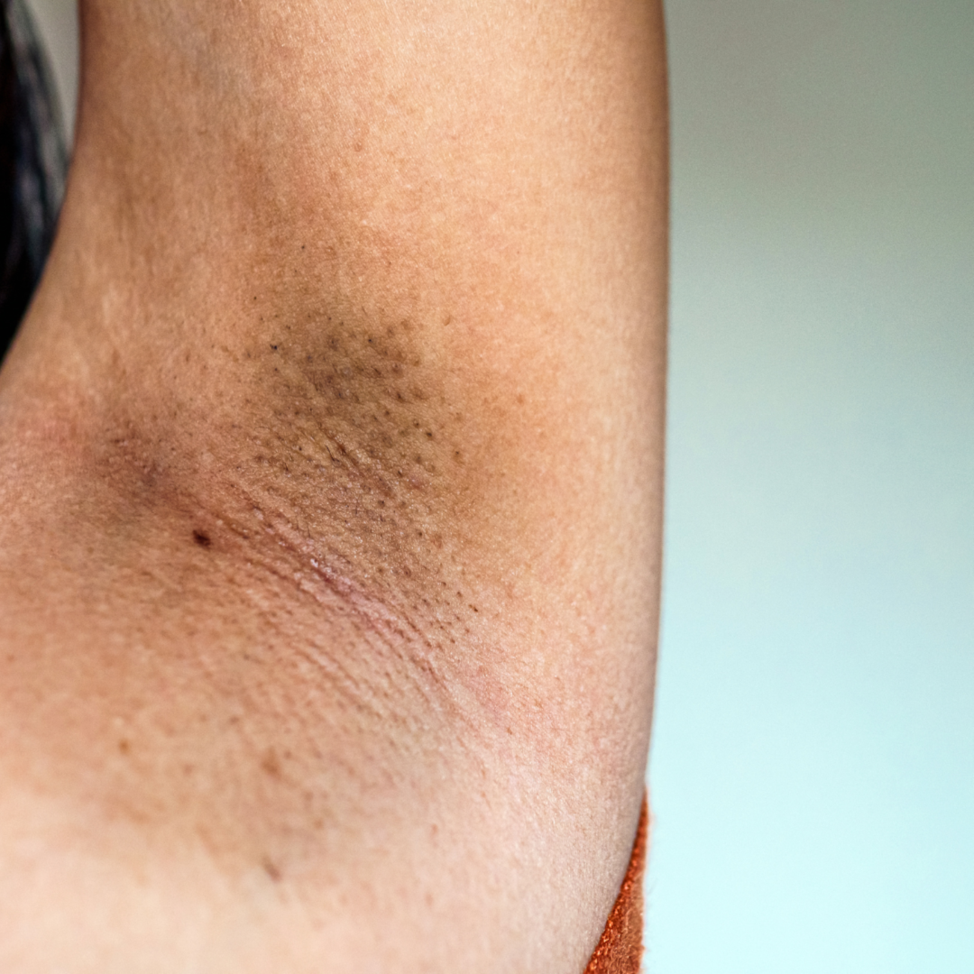 Specialized Care for Body Spots