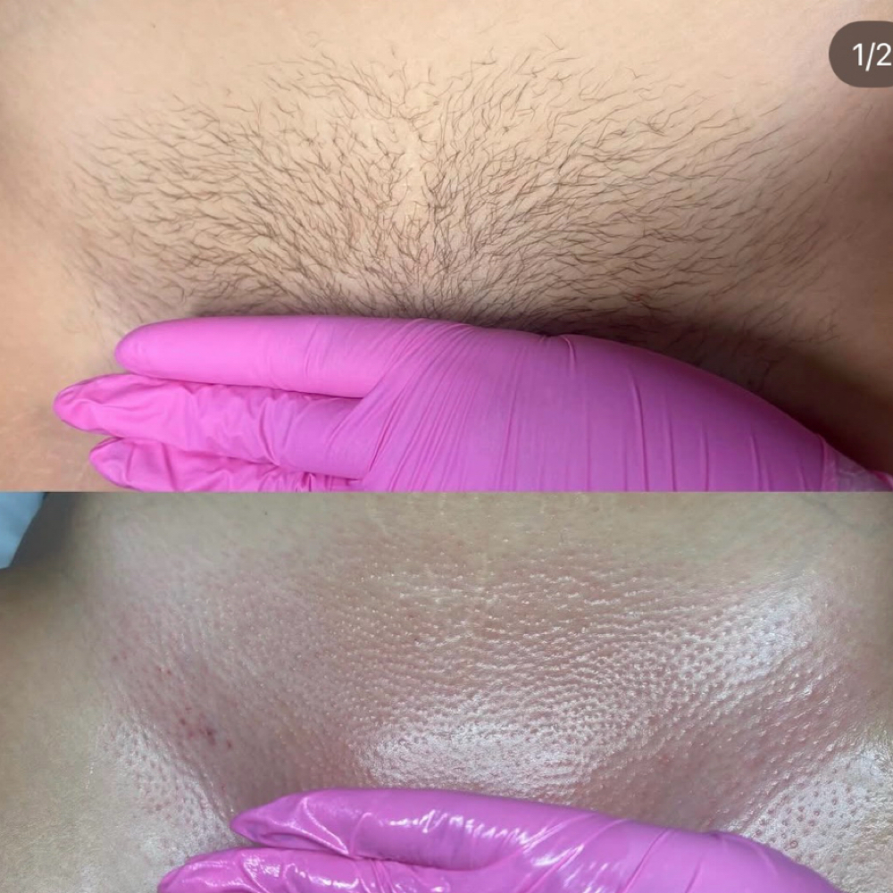 Brazillian Wax at Crystal Vision Beauty in Picayune, MS