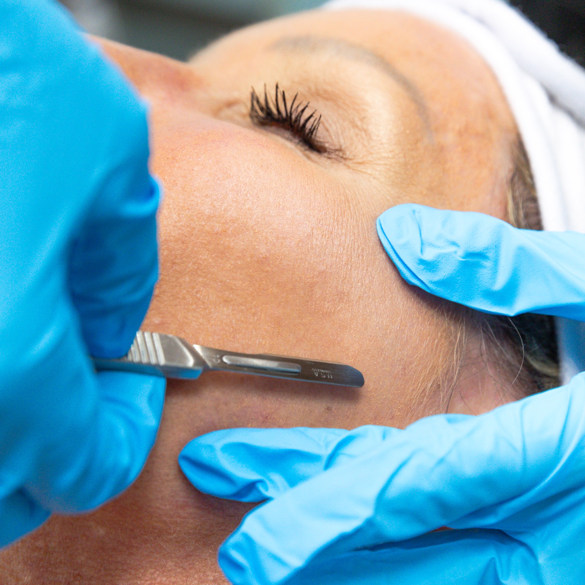 Dermaplaning Add-On at Iron Rose Massage LLC in Peoria, AZ