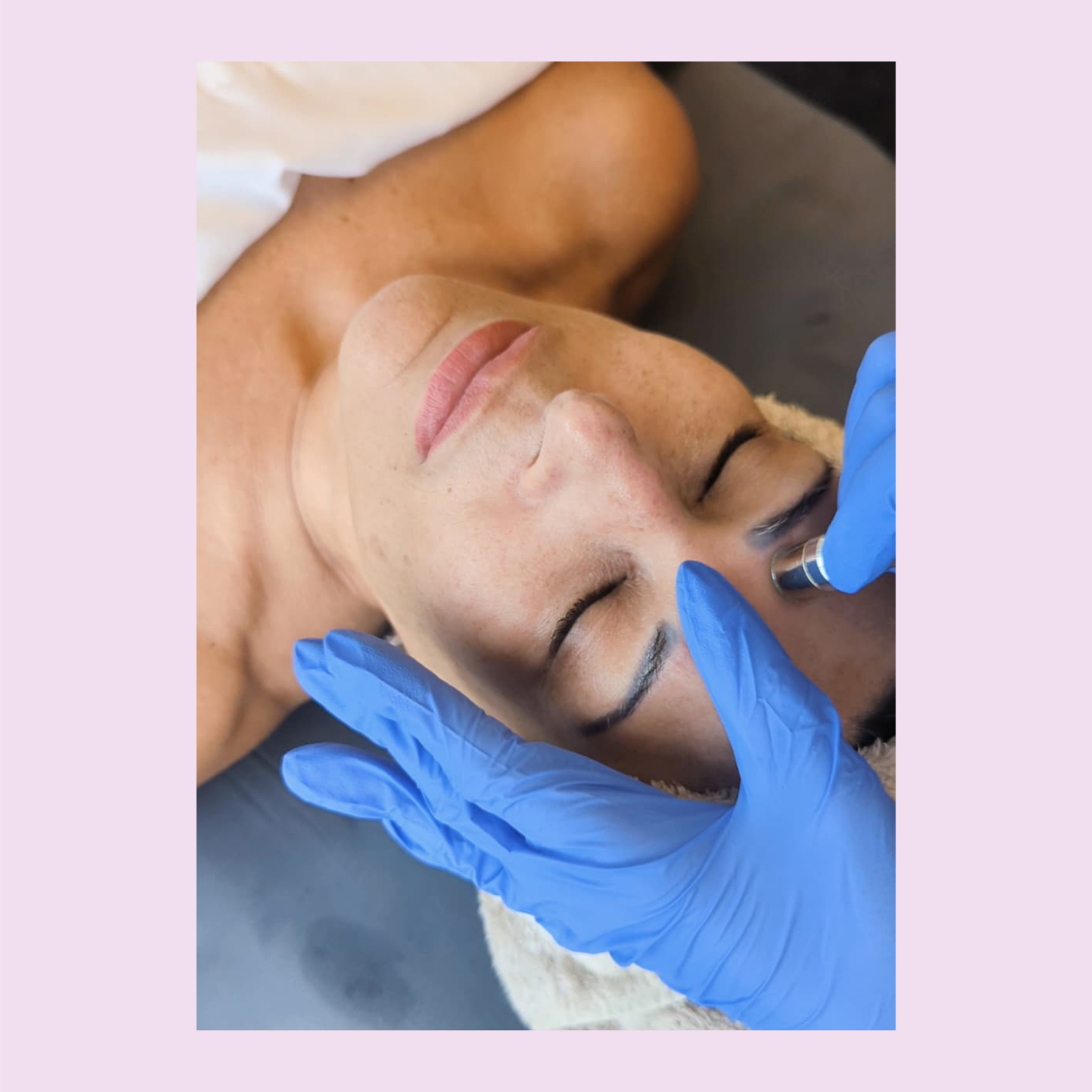 European Facial + Microdermabrasion at Lumun Esthetics in Arlington, MA