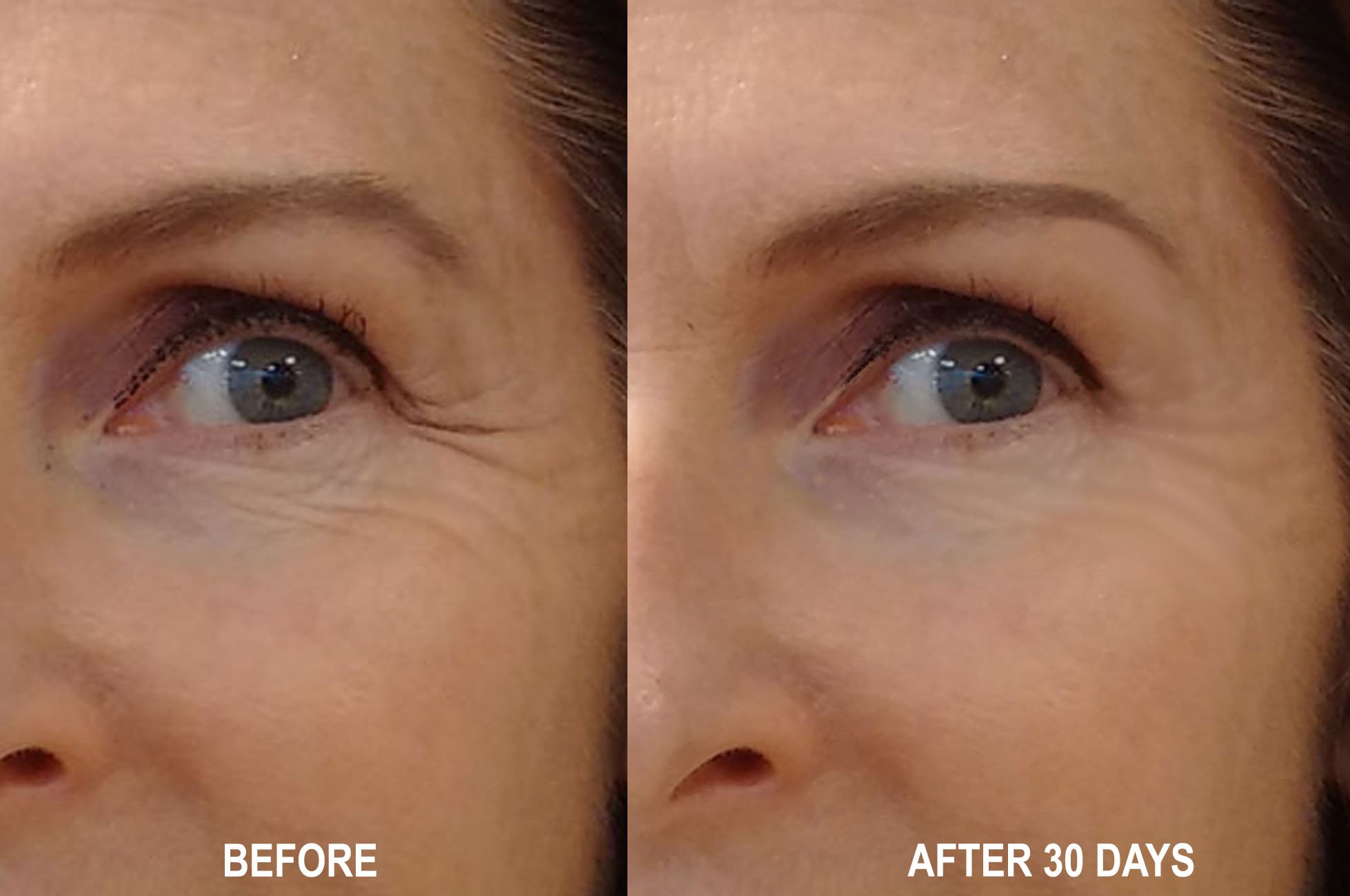 BabyBotox Facial