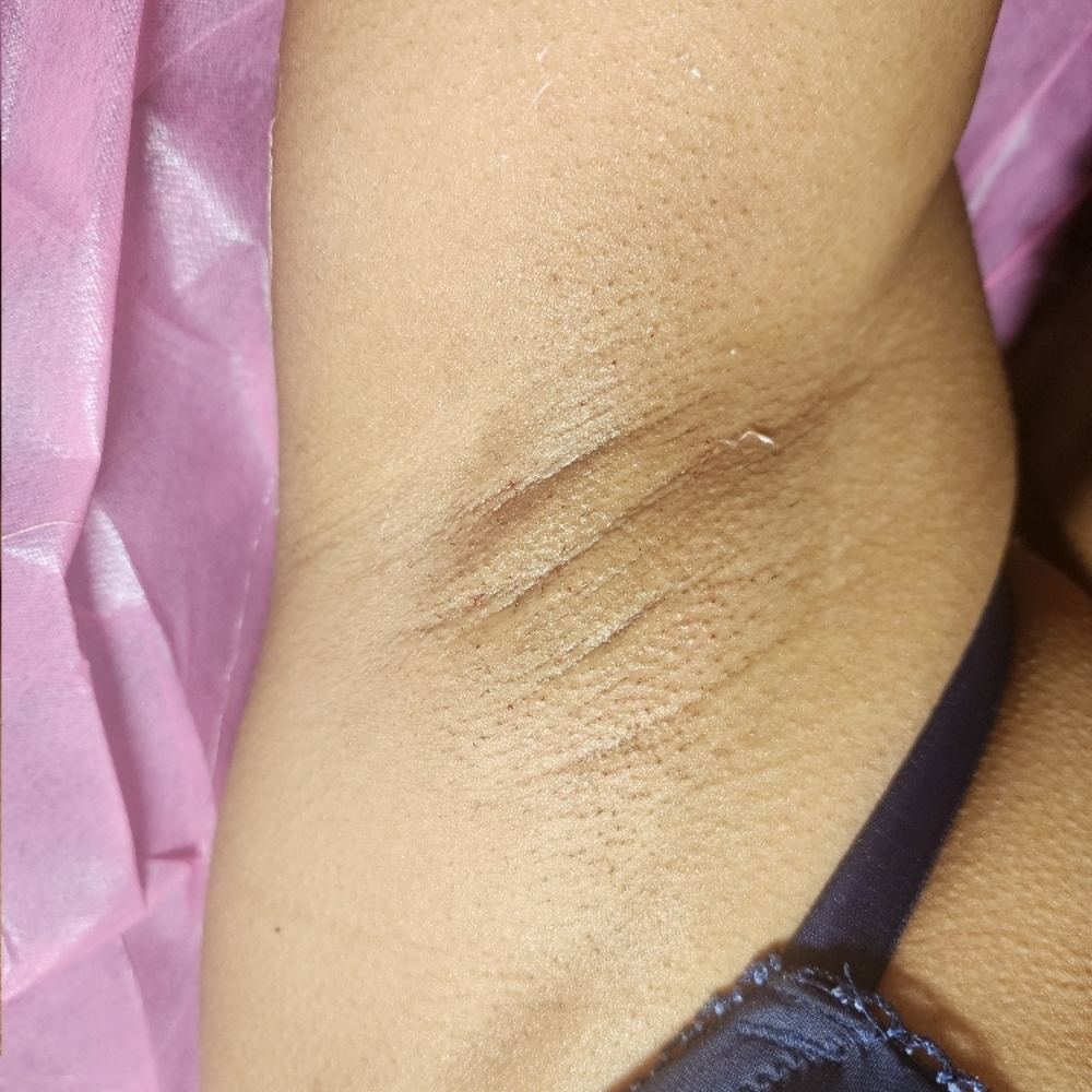 Under arm wax at 11:11 Skin & Beauty in Concord, NC