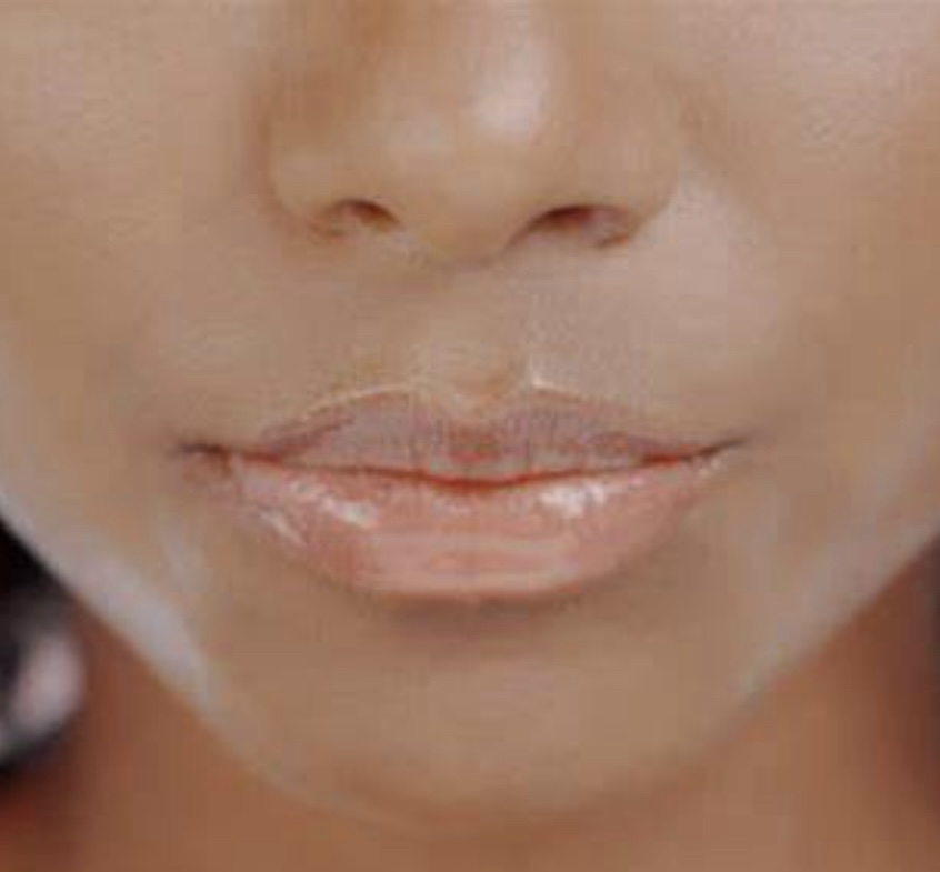 Lip/ Chin