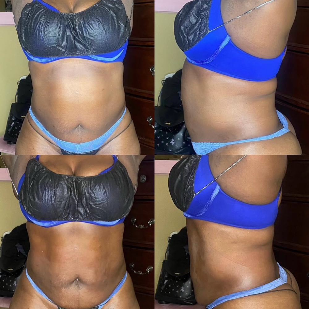 Body Sculpt Session at Diamond Beauty Studio in Rialto, CA