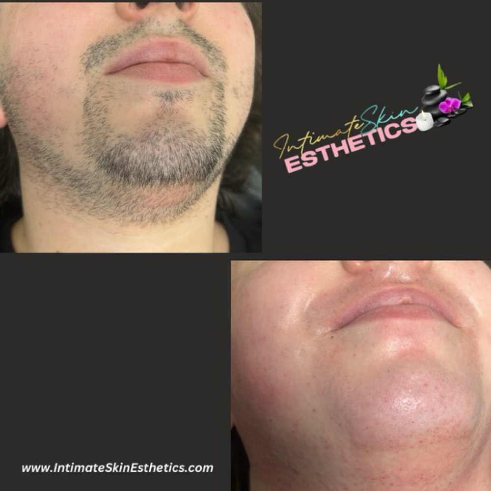 Face Waxing at Rockii’s intimate skin & esthetics in Va Beach, VA