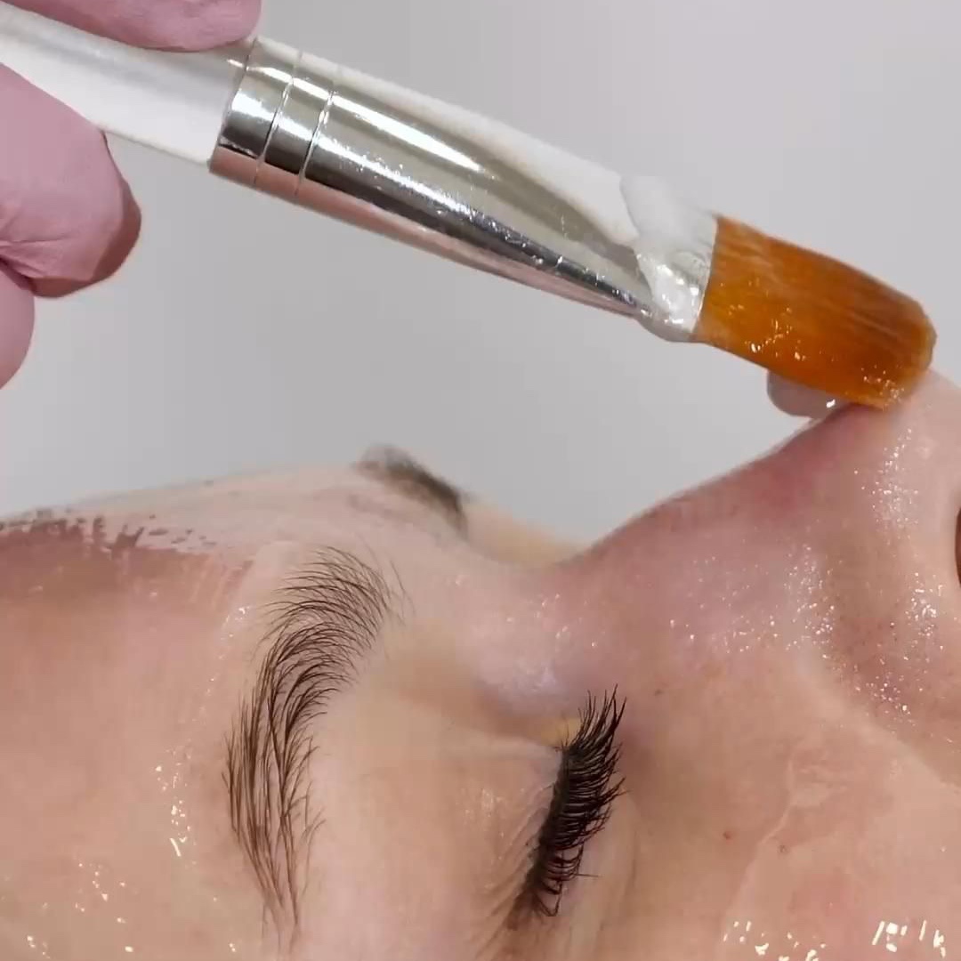 VI PEEL PURIFY at Remake Beauty Studio San Juan in San Juan, TX