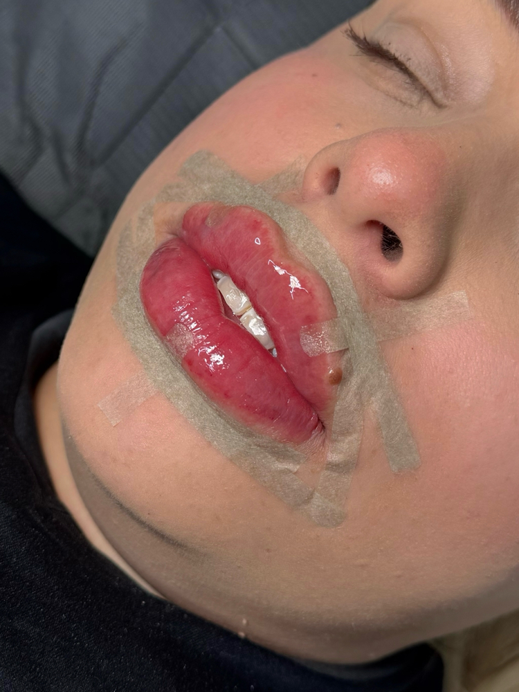 Touch Ups at Al’Aura Aesthetics in Denver, CO