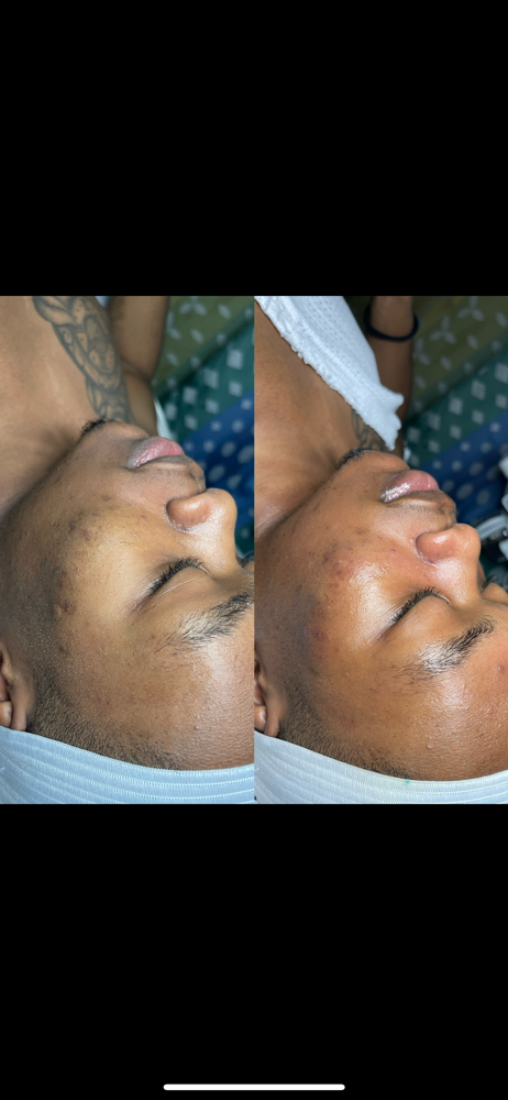Just For Men(Facial)