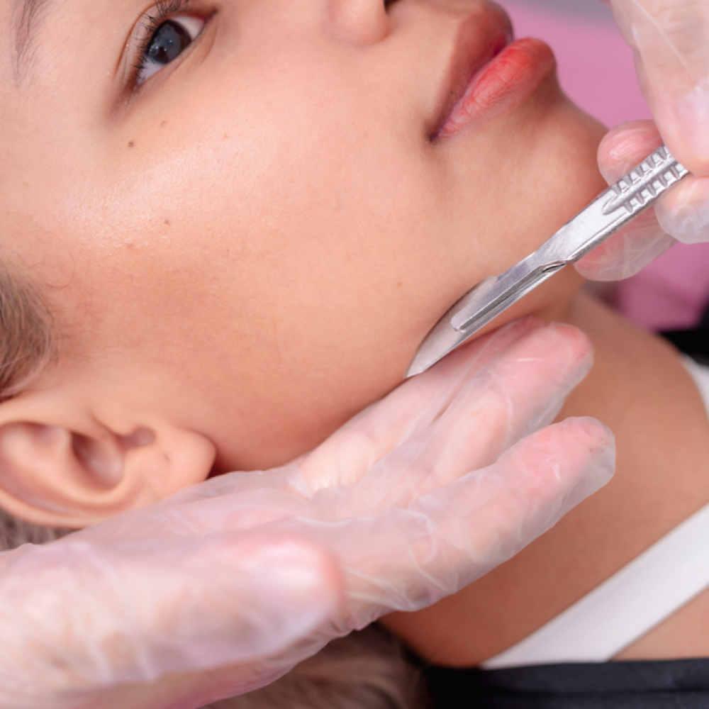 Dermaplaning Facial at Lunar Beauty Suites in Logan, UT