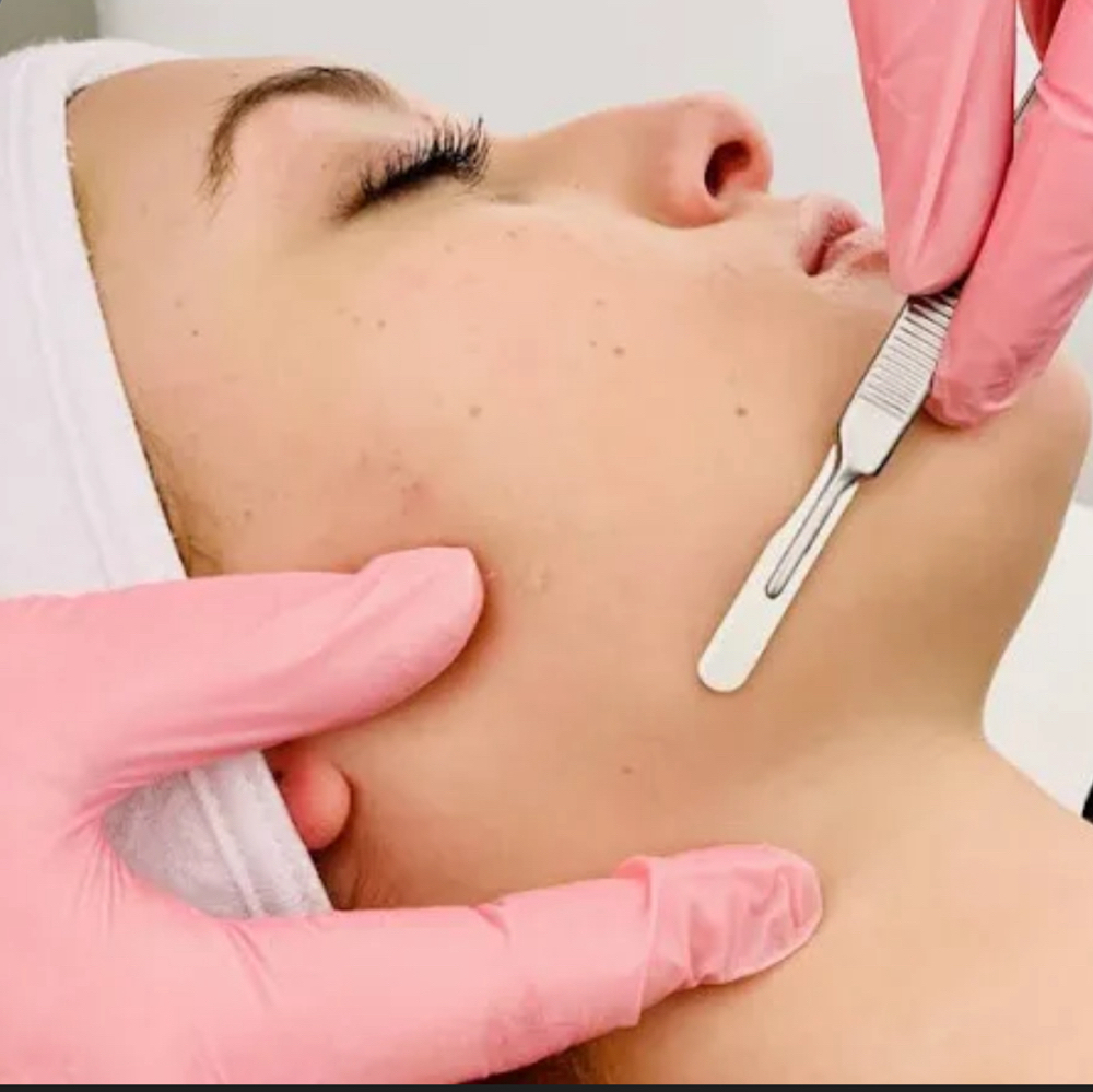 Dermaplane Facial