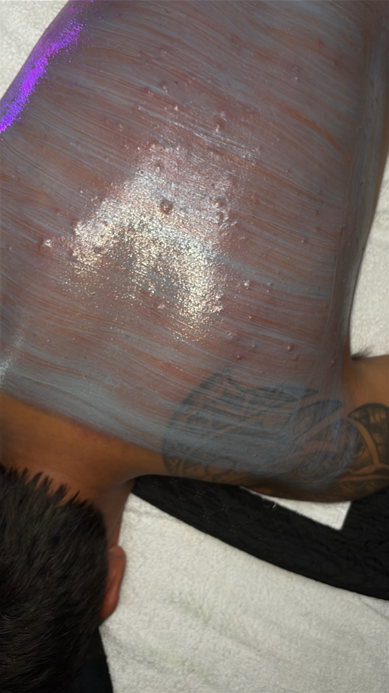 Lizards Back Treatment 🫧