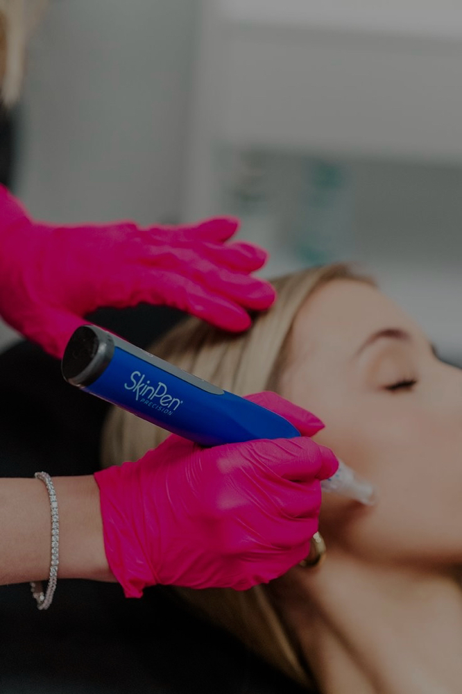 Microneedling w/ Skinpen