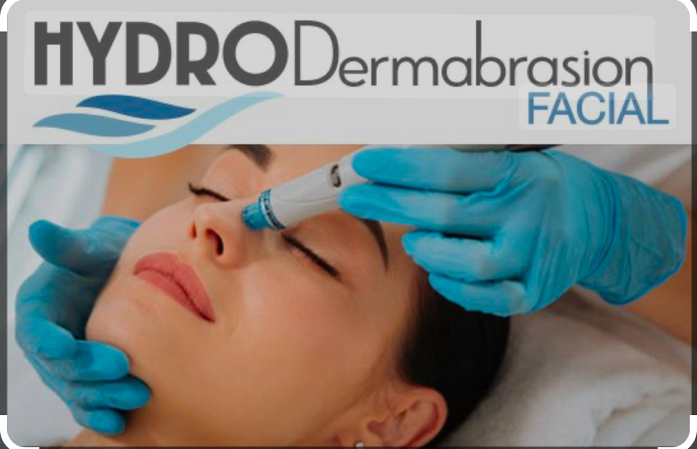 Hydro- Dermabrasion Co2 Facial at MylaSkinCare in Los Angeles, CA