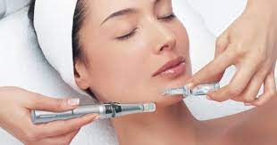 Microneedling