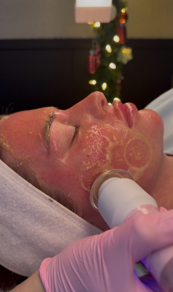 Glo2 Bubble Facial at 01 Esthetics in DeQueen, AR