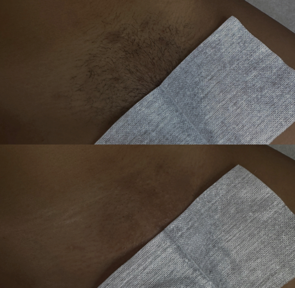 4 Brazilian Wax Package