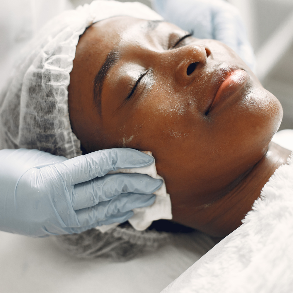 Customized Chemical Peel