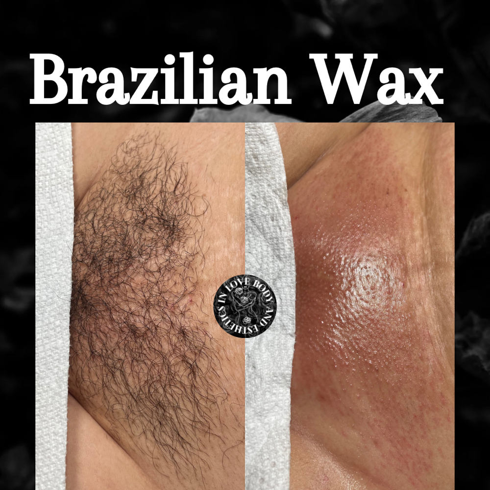 Waxing- Brazilian