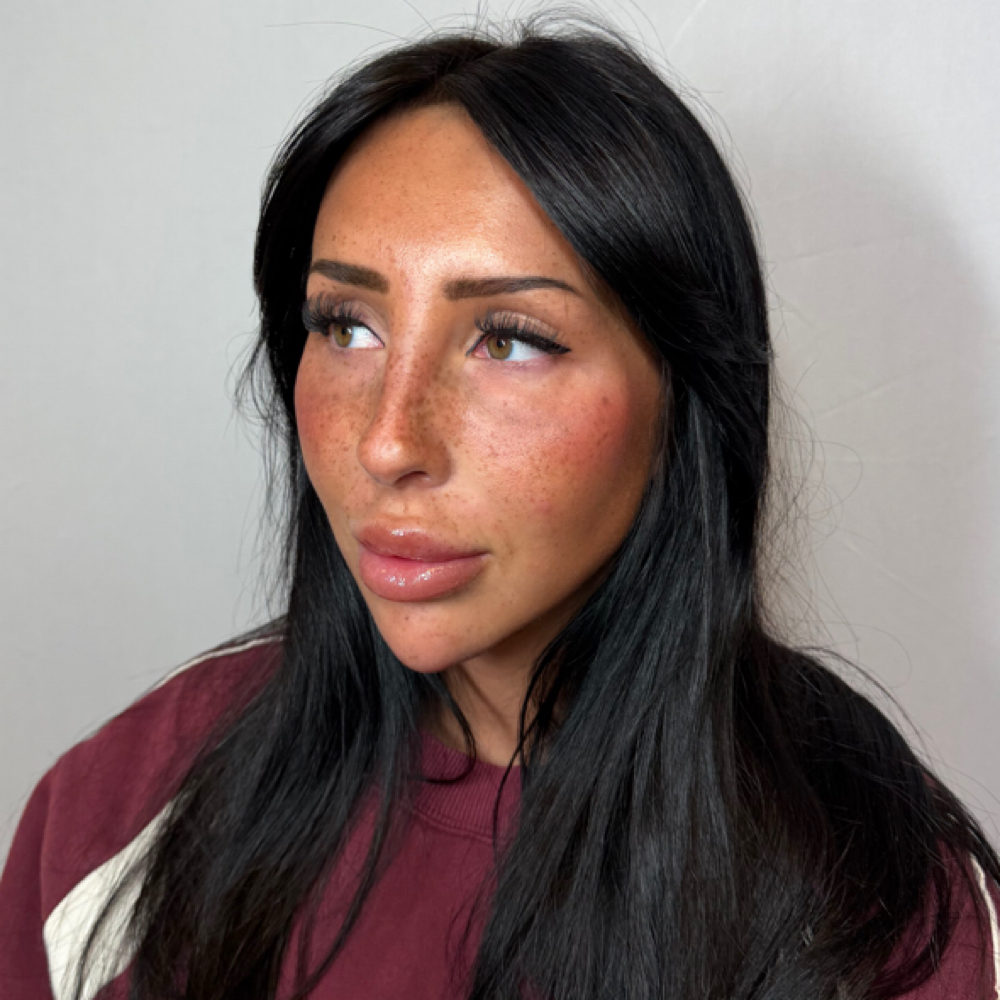 That's Hot Face Lift 6ML+ at Eluxy Aesthetics in Arlington, TX