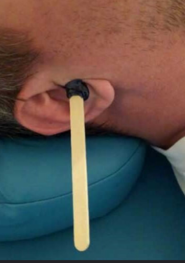 Inner Ear  Hair Removel
