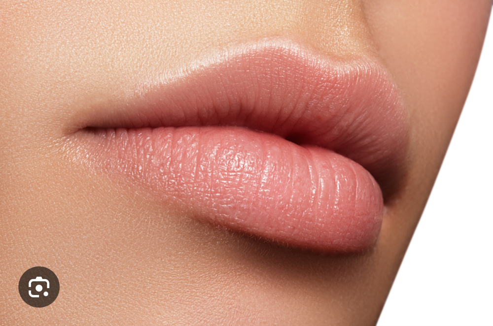 Lip Filler (Half Syringe 0.5ml)