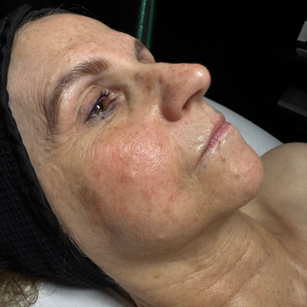 Brow Lamination at The Proverbs Studio in Bessemer City, NC