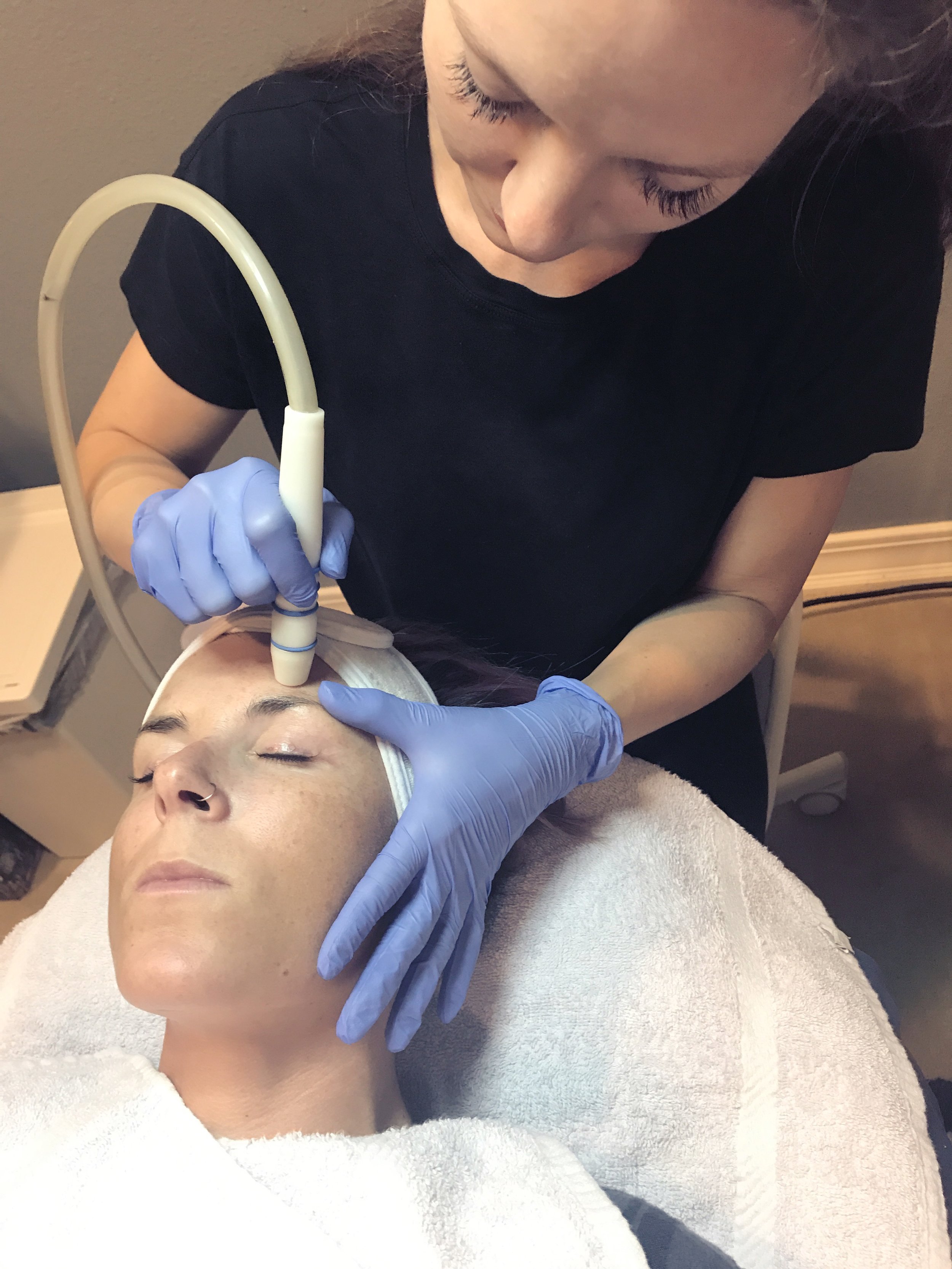 Microdermabrasion