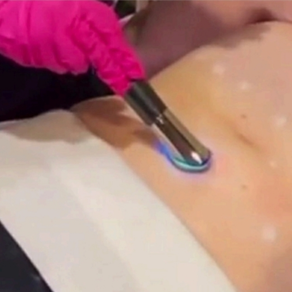 Fat Dissolve Return Appointment Treatment at Le Bar Beaute in Indian Trail, NC