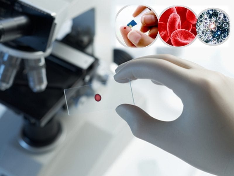 Health Performance-Blood Analysis