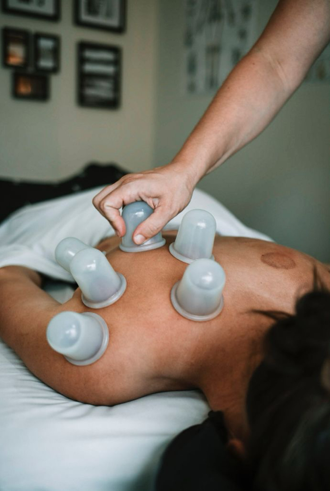 Cupping Therapy