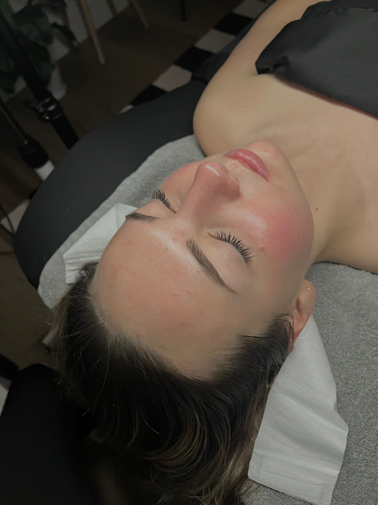 6 Month Facial Membership
