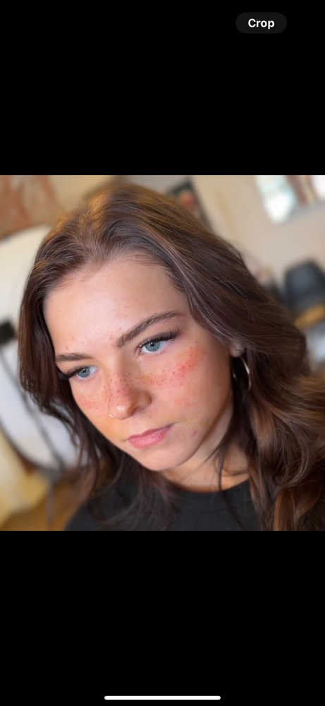 Fake Freckles