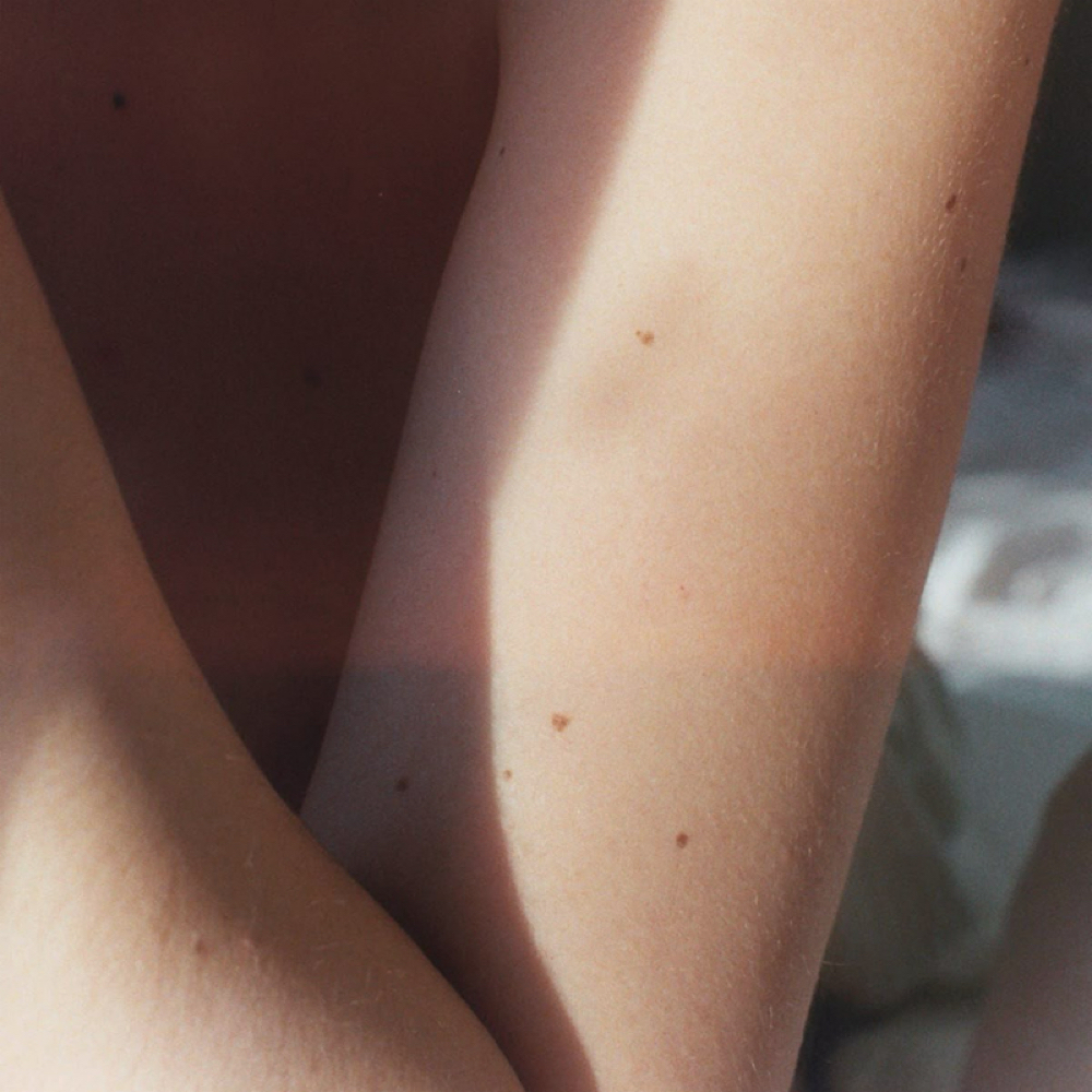 Dainty Freckles at STORMI SKYN in Lubbock, TX