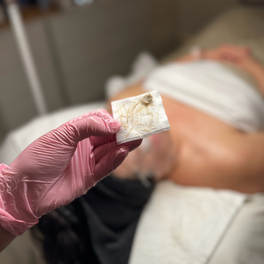 Leona’s Signature 90 Minute Facial at Lady Leona Aesthetics- Bristol in Bristol, PA